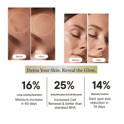 Advance Detox Serum