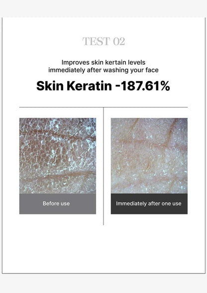 Before and after comparison of skin texture improvement with Skin Keratin, showing a decrease of 187.61%.