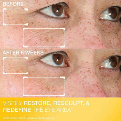 Contour Restore® Firming Moisture Balm for Eyes
