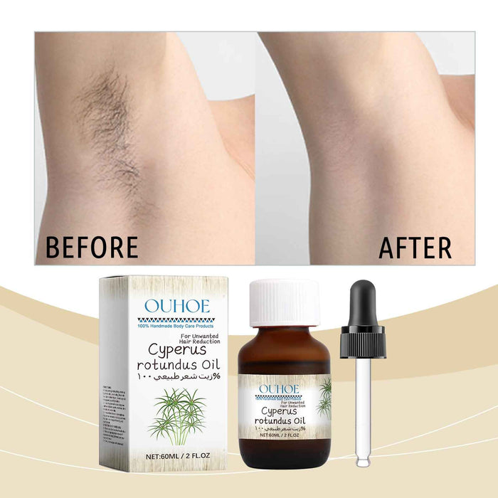 EELHOE 100% Cyperus rotundus Oil – Slow Regrowth & Soothe Skin After Hair Removal 1 bottle EELHOE COSMETICS