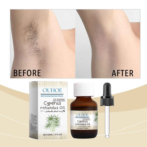 EELHOE 100% Cyperus rotundus Oil – Slow Regrowth & Soothe Skin After Hair Removal 1 bottle EELHOE COSMETICS