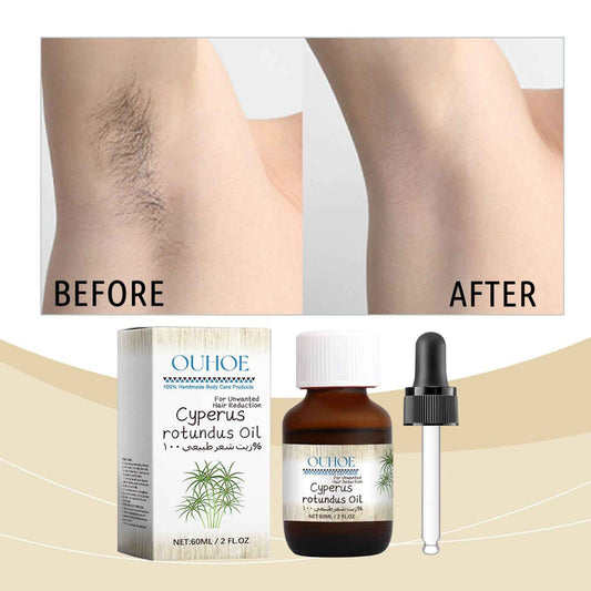EELHOE 100% Cyperus rotundus Oil – Slow Regrowth & Soothe Skin After Hair Removal 1 bottle EELHOE COSMETICS