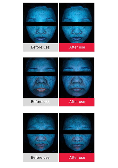Before and after use comparison of a skincare product on a person's face.