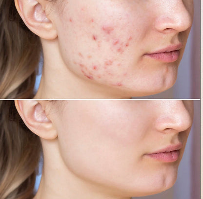 Glycolic Serum
