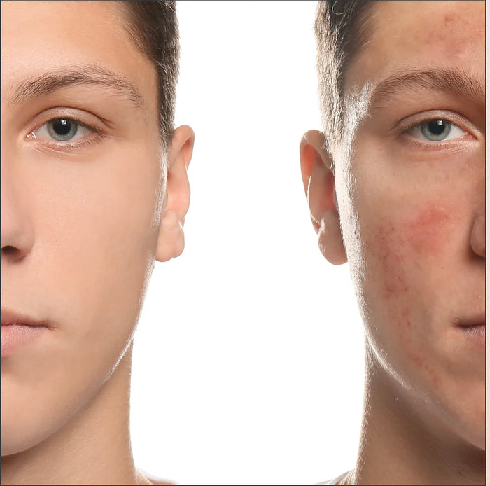 Glycolic Serum
