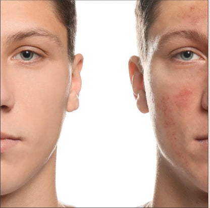 Glycolic Serum
