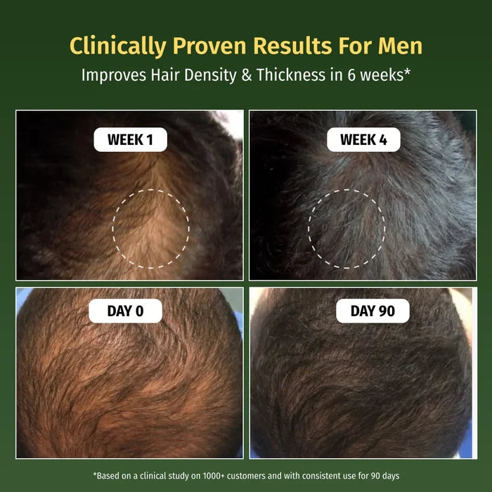 vilvah hair growth serum improves hair density and thickness