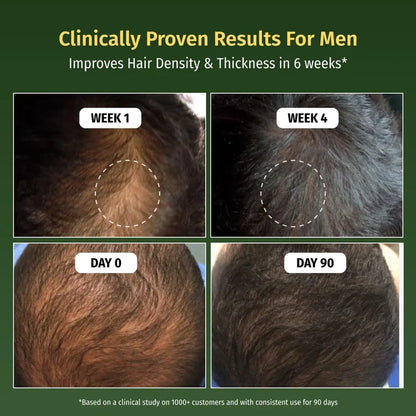 vilvah hair growth serum improves hair density and thickness
