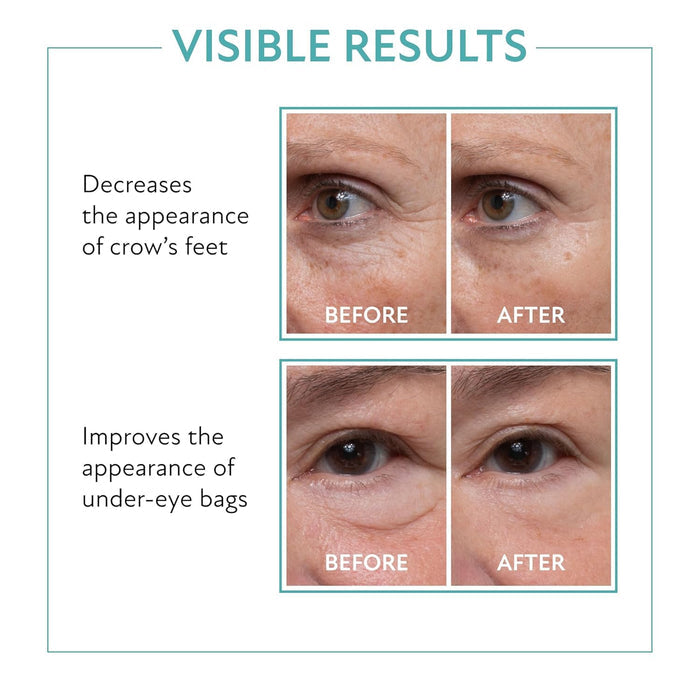 Instant Eye Lift Duo