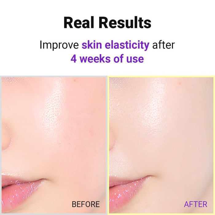 ISNTREE Hyper Retinol EX 1.0 Serum 20 mL