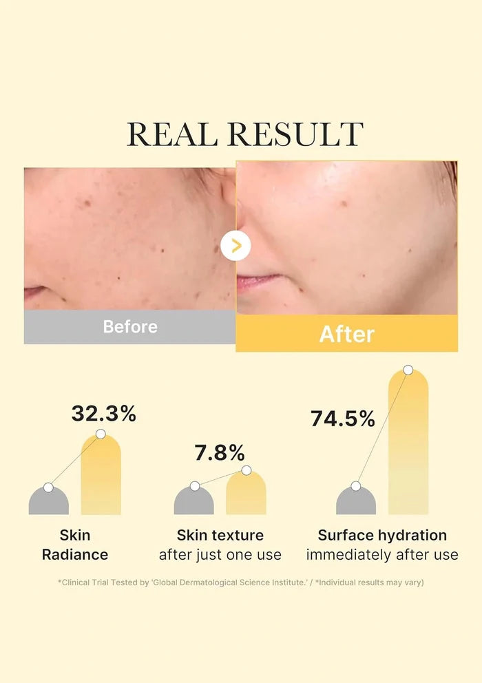 Before and after comparison of skin treatment with statistical results on a beige background