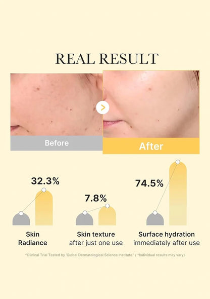 Before and after comparison of skin treatment with statistical results on a beige background