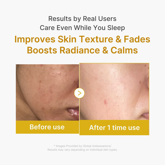 Medicube Kojic Acid Turmeric Night Wrapping Mask - 75ml