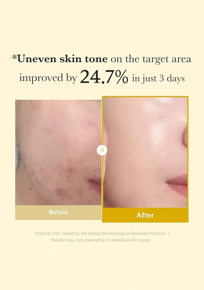 Before and after comparison of skin tone improvement with text indicating a 24.7% improvement in just 3 days.