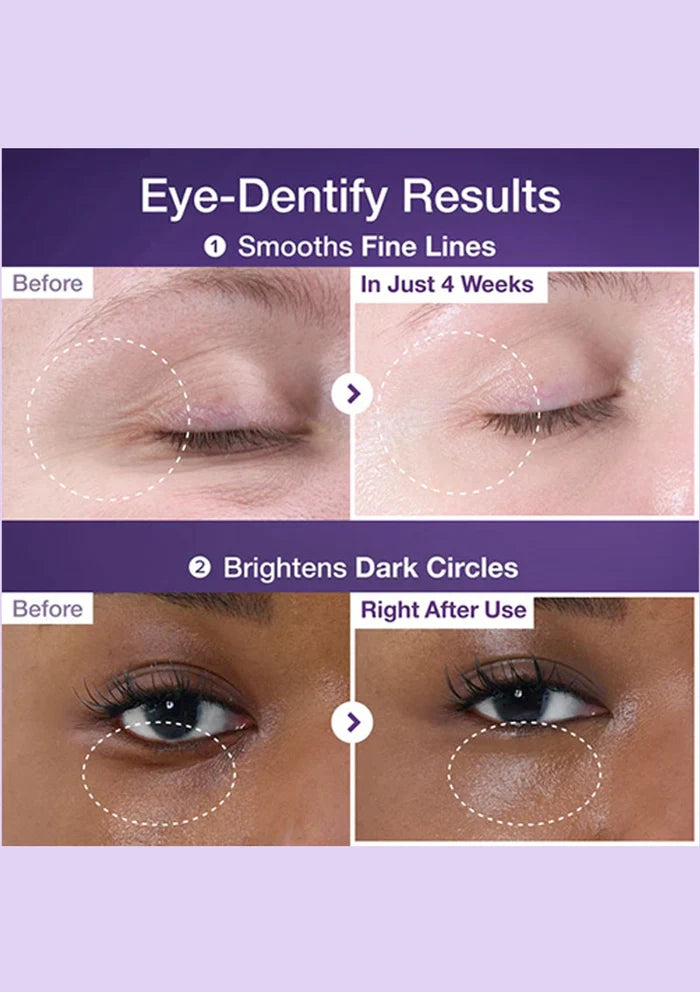 Before and after effects of eye cream on fine lines and dark circles with a purple background.