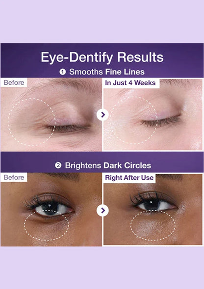 Before and after effects of eye cream on fine lines and dark circles with a purple background.