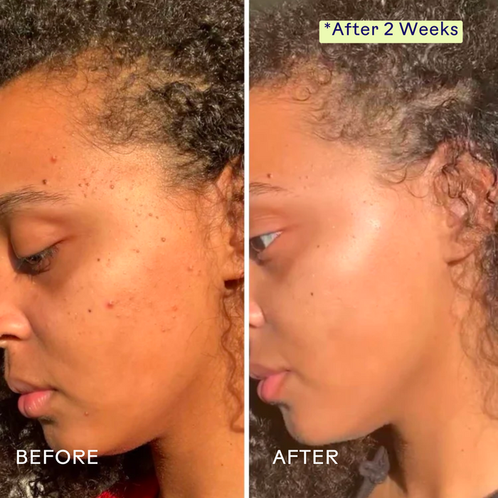 Three Ships-Superfruit Lactic + Multifruit 8% AHA Exfoliating Mask-Skincare-628110639578_4_B_A-The Detox Market |