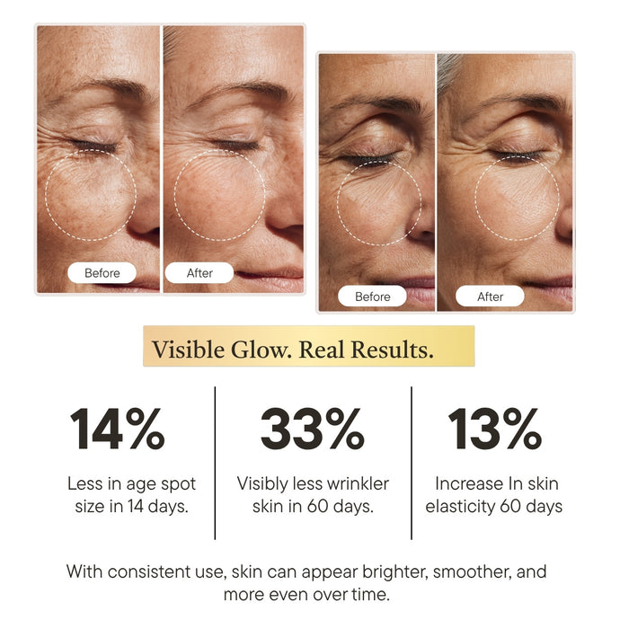 Skinact Vitamin C Brightening Serum  | Before and after effects of a skincare product on skin, with visible improvements in age spots, wrinkles, and elasticity.